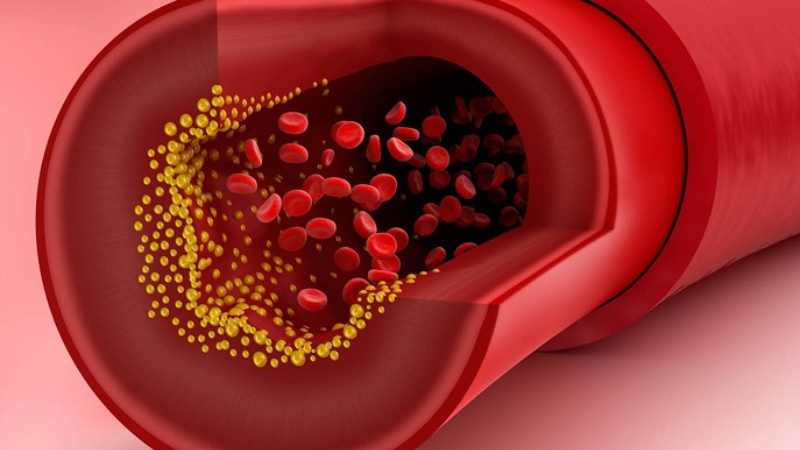 Không phải cholesterol nào cũng xấu