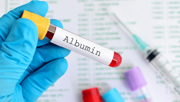 Albumin là gì? Tầm quan trọng của xét nghiệm Albumin với sức khỏe