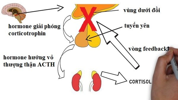 Hormone ACTH: chức năng và ý nghĩa xét nghiệm - <strong>Klept.com.vn</strong>” width=”600″ height=”337″ data-lazy-sizes=”(max-width: 600px) 100vw, 600px” title=”hormone-acth”><figcaption id=