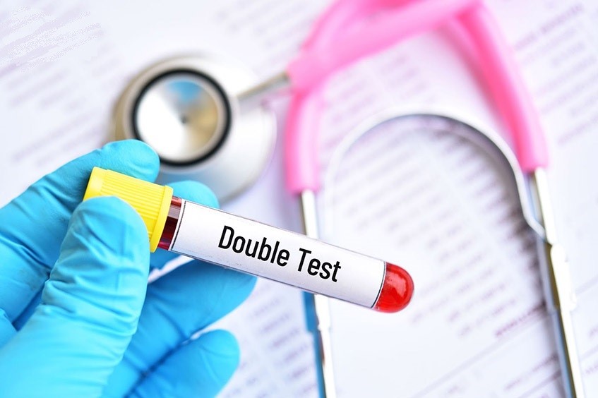 Xét nghiệm double test là gì? Có nên thực hiện không?