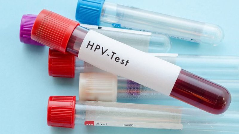 Xét nghiệm HPV là gì? Lưu ý và cách đọc kết quả xét nghiệm - <strong>Klept.com.vn</strong>” width=”600″ height=”338″ data-lazy-sizes=”(max-width: 600px) 100vw, 600px” title=”xet-nghiem-hpv”><figcaption id=